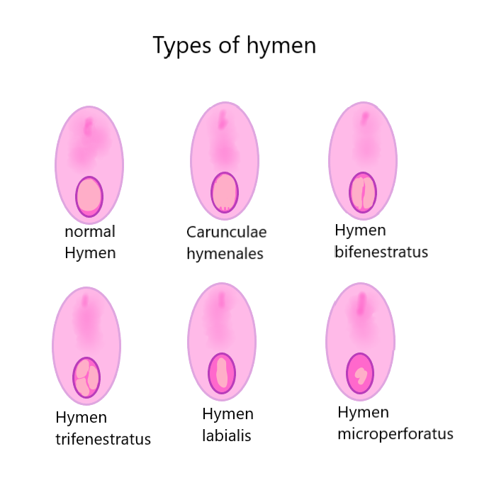Hymen In Female what is hymen?-female virginity